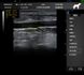 Dawei P8 doppler ultrasound, veterinary with microconvex, phasing and line sensors