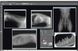 CR 7 Vet Image Plate X-ray Scanner, Software