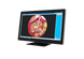 Стаціонарна ендоскопічна система All-in-One TK-VETKIT для ветеринарії