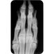 Рентген пластина размер "5" (1 шт. В комплекте) 5.7x9.4cm