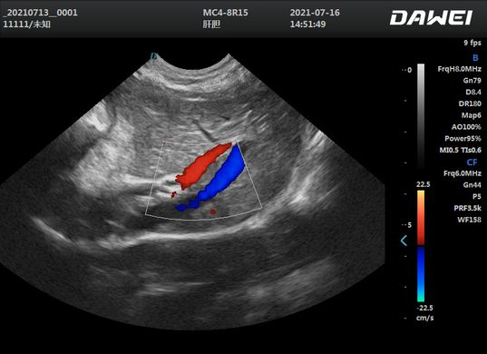 Dawei L6 pro, doppler ultrasound, veterinary with microconvex and linear sensors