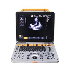 Dawei P60, doppler ultrasound, veterinary with microconvex, phasic and linear sensors