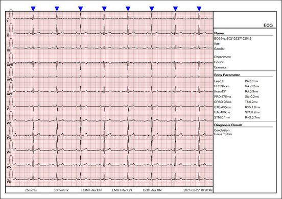 12-Channel Multi-Parameter Electrocardiograf
