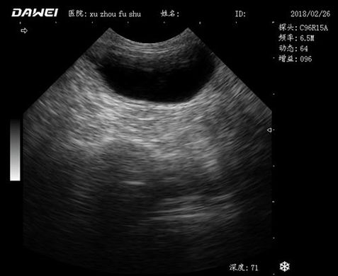 MU12, ultrasound machine, veterinary. Dawei